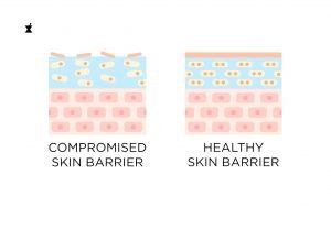 skin barrier graphic