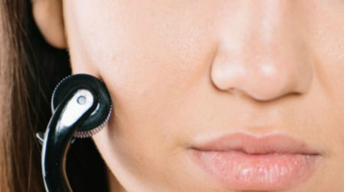 Microneedling At Home: A Derm-Approved Guide