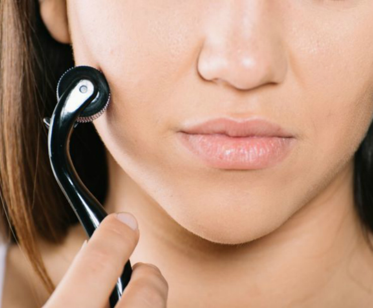 woman holding microneedler to face