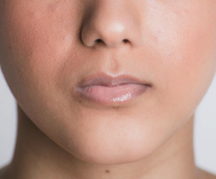 Smooth Lips: Singapore's Topical Treatments for Lip Wrinkles