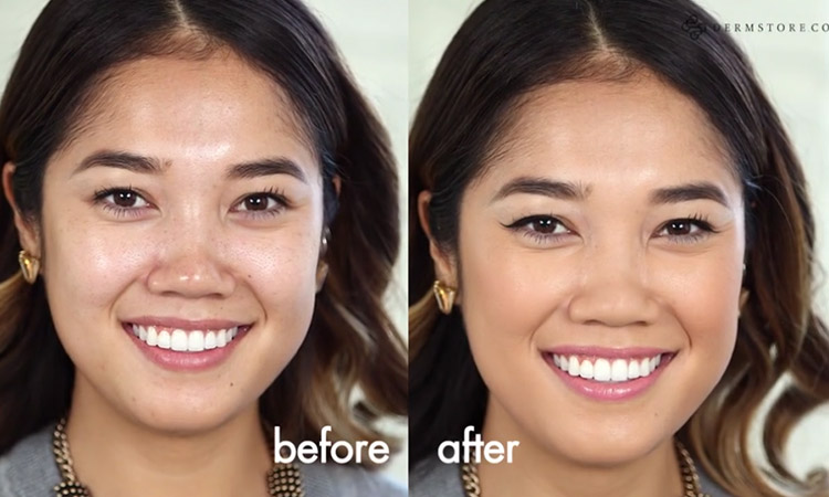 How to Cover Up Major Skin Concerns Using Dermablend Makeup