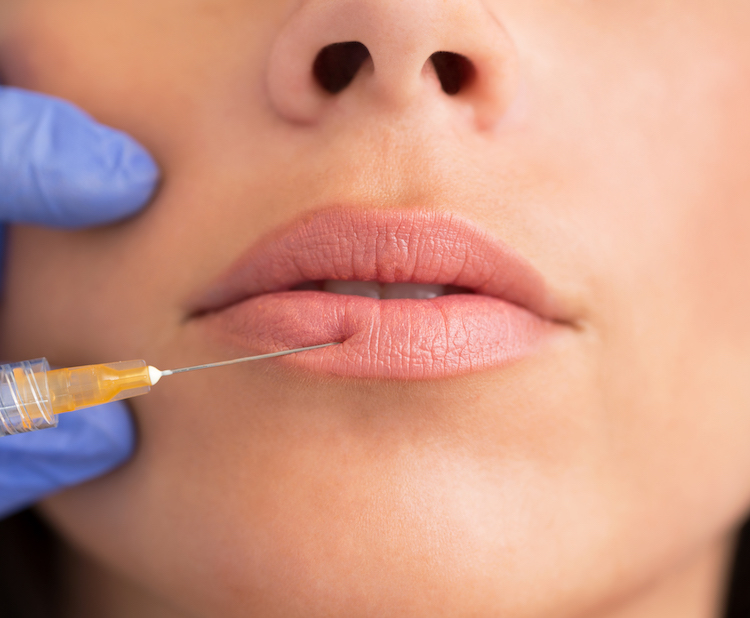 woman getting lip injections