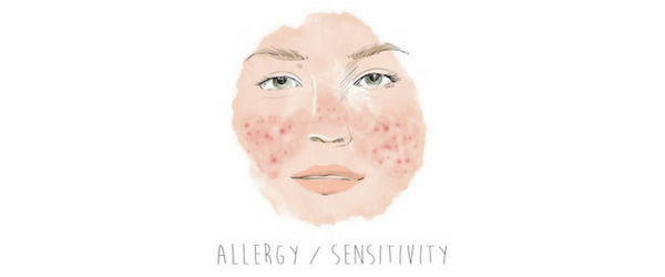 allergy sensitivity