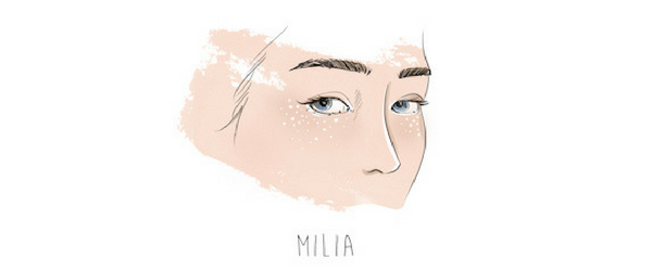 milia