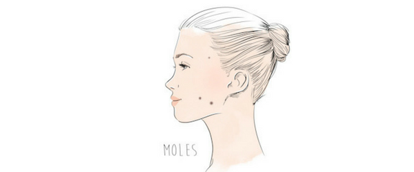 moles