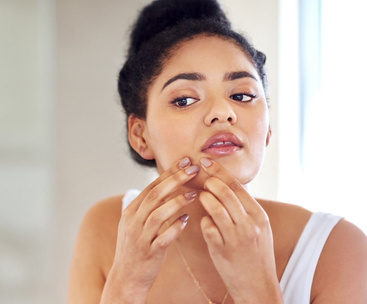 woman squeezing a pimple