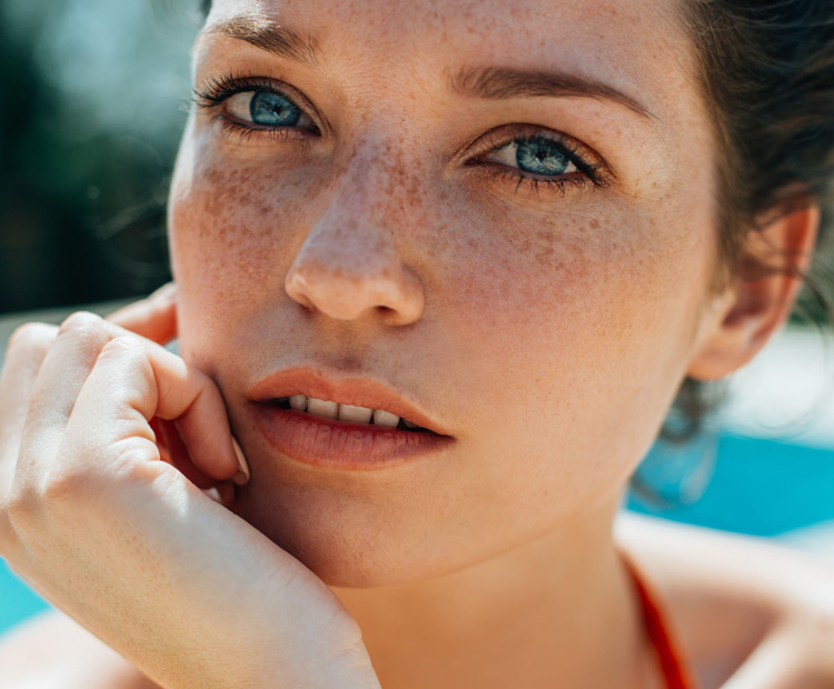 model with freckles