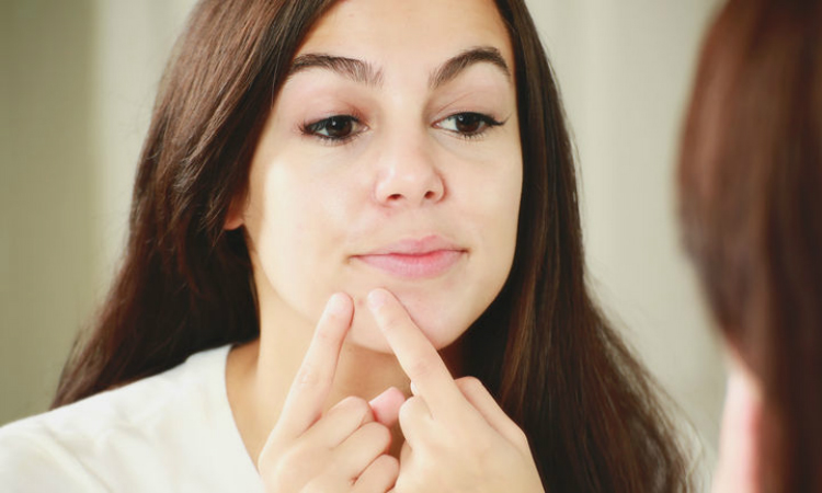 Top 5 Reasons Why Your Pores Look Big