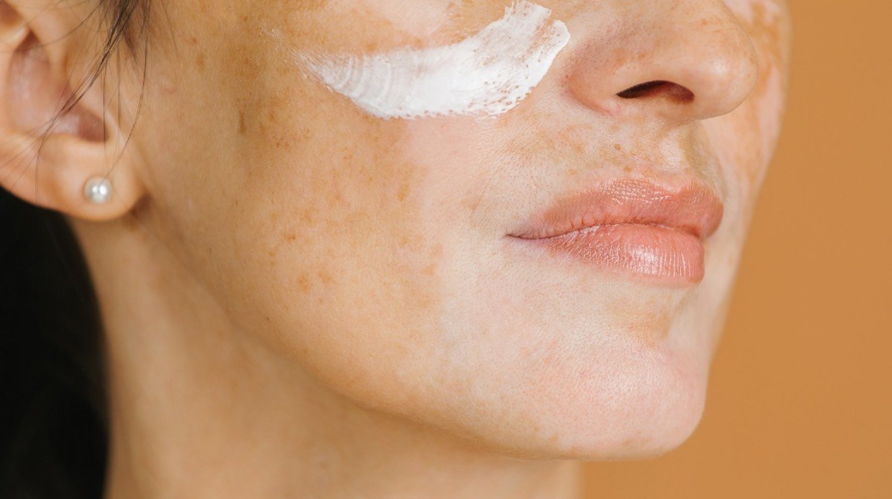 How to Repair a Damaged Skin Barrier