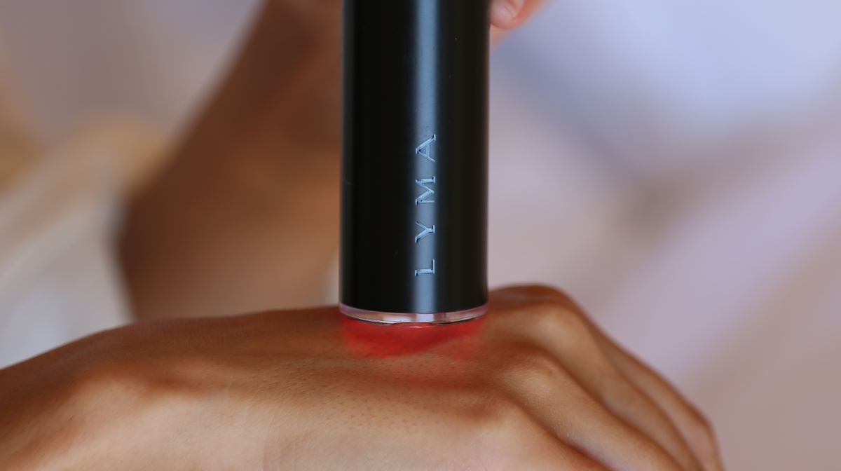 LYMA Laser being used on hand