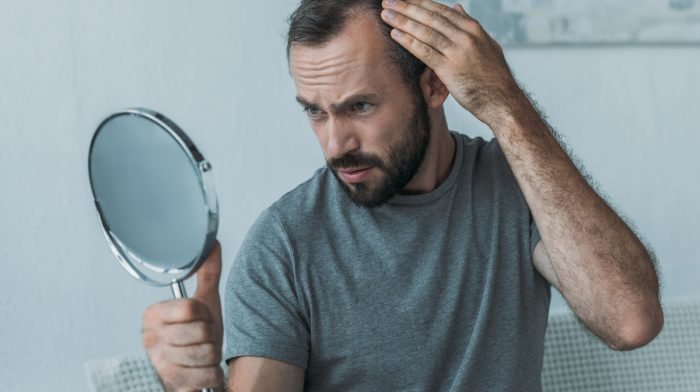 What Causes Telogen Effluvium?