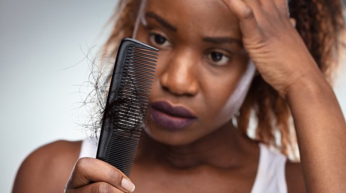 What Is Thyroid-Related Hair Loss?