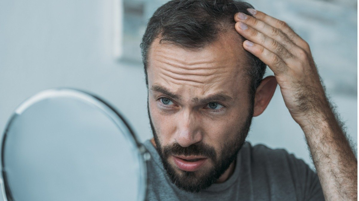 How To Prevent Hair Loss
