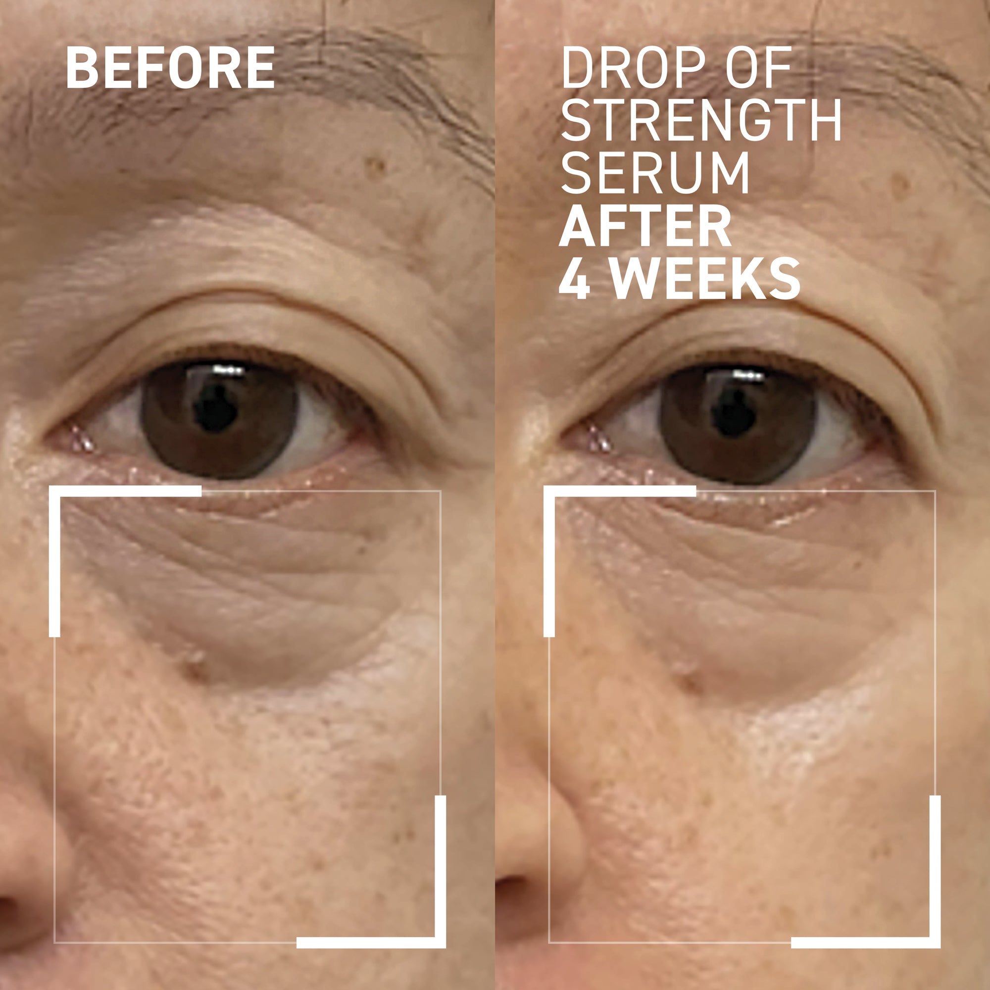 before and after results after using Dr Brandt serum