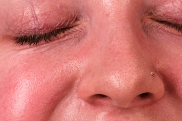 Up close on skin care