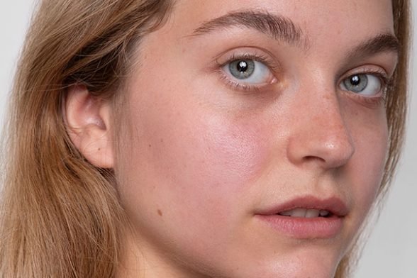 Exfoliating with acids? Here's what you need to know