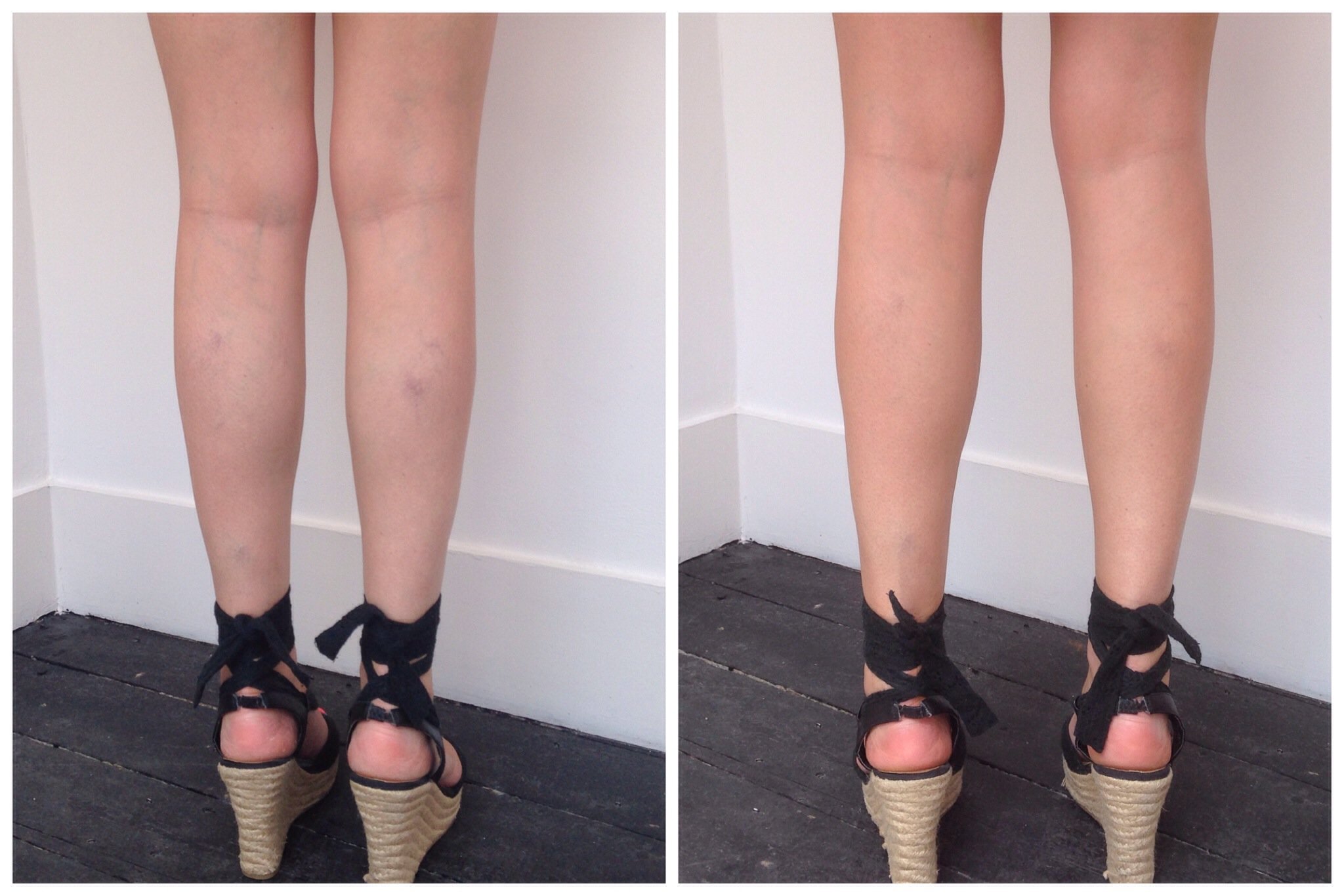 Leg Make Up to Cover Veins