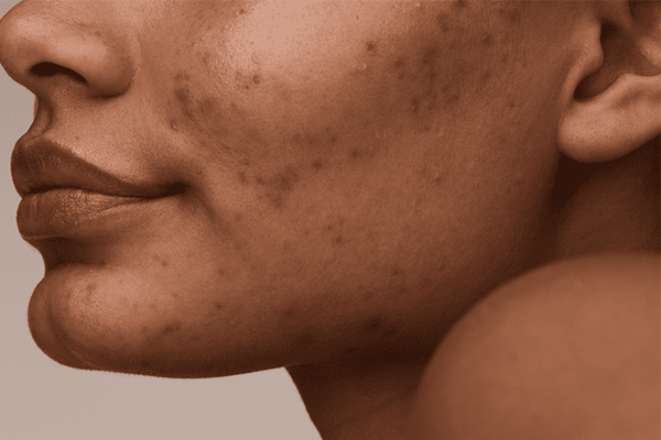 Boost Your Barrier: 4 New Sensitive Skin Essentials