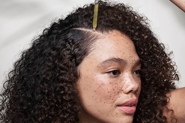 Woman treating her dry scalp 