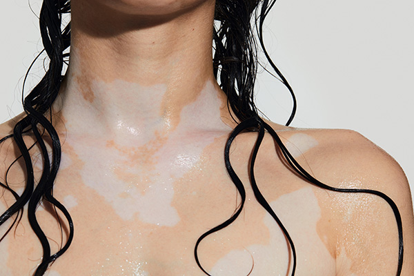 A close up of a female model's neck and decollete as she is in the shower. The model is wet with wet curly hair and has pigmentation on her skin.