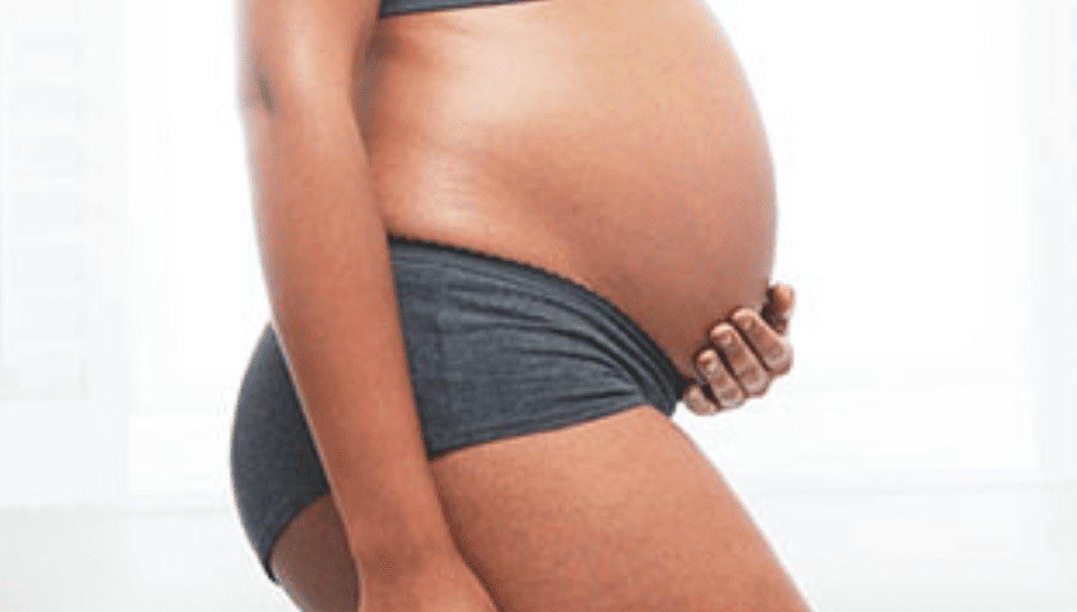 Mama In The Know: What Are Pregnancy Stretch Marks?