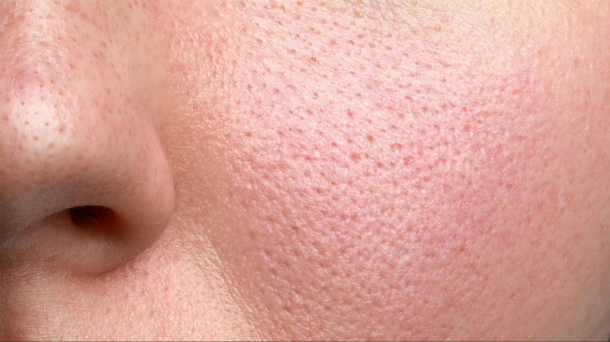 How can pores be tightened for clearer skin?
