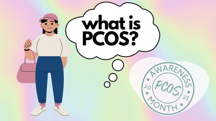 Everything You Need to Know About PCOS