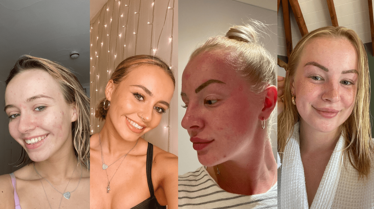 Real skin stories with LOOKFANTASTIC