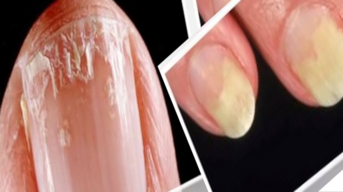 Our Guide To Strengthening Weak Nails