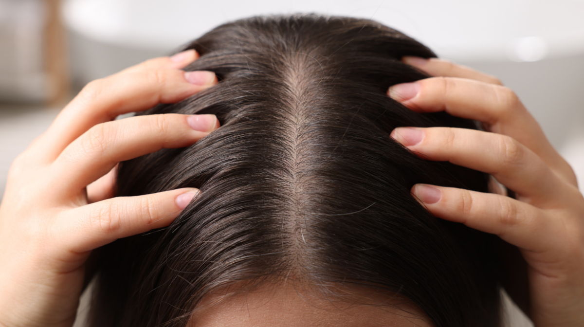 Woman touching her scalp.