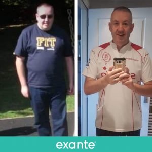 Alex has lost 10 stone using the exante 800 plan