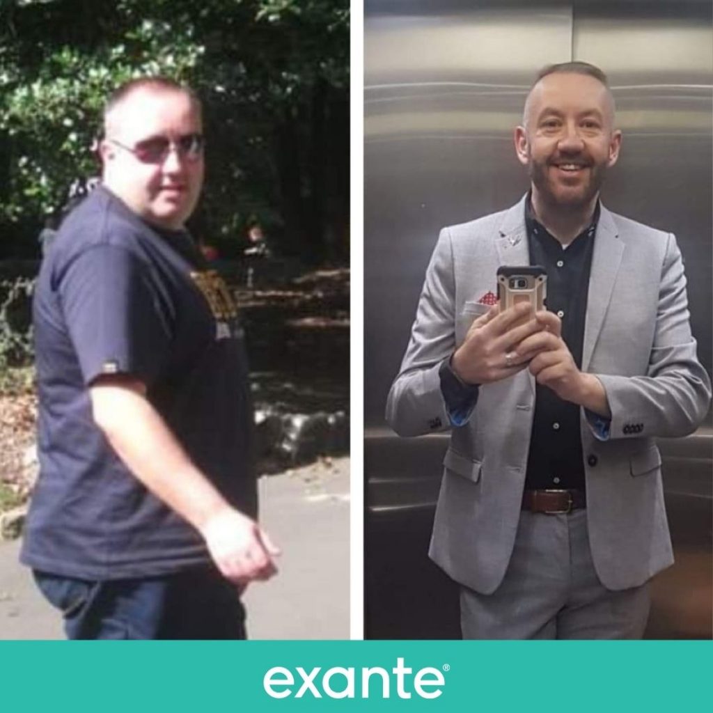 Alex has lost 10 stone using exante