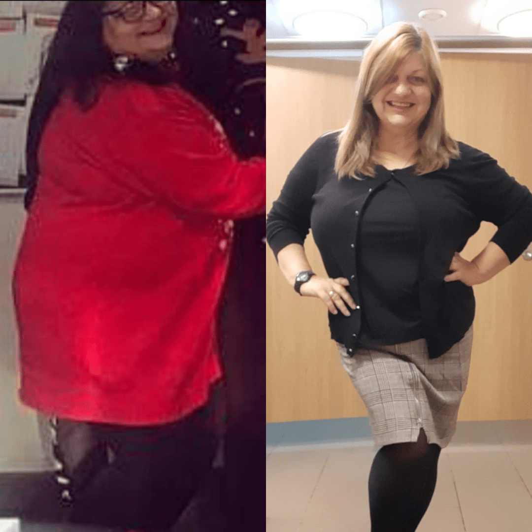 Lisa put her diabetes into remission on an 850 calorie shakes and soups plan