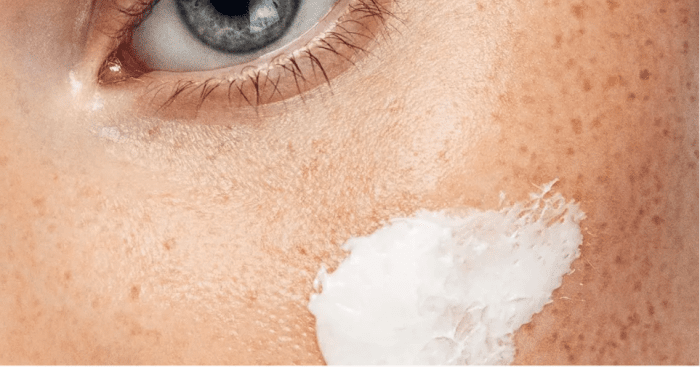 How to get rid of dark circles