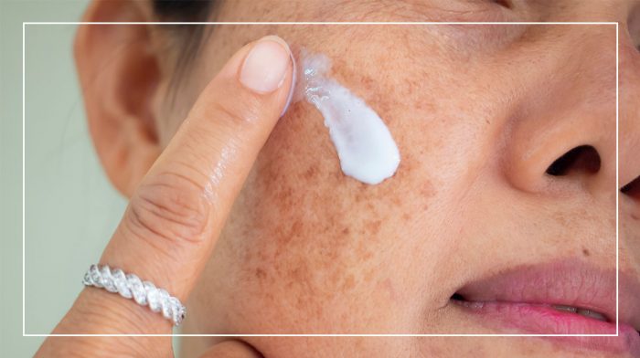 Har du pigmentfläckar? Då borde du testa den här nya hudvårdsserien!