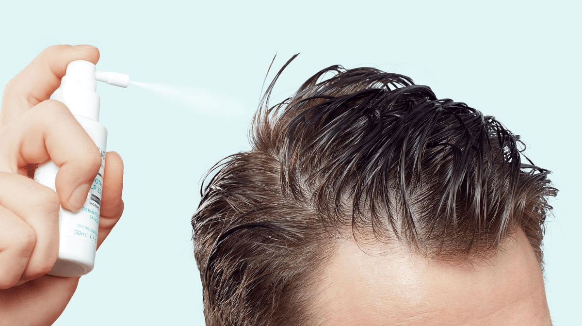 5 Steps For Successfully Treating A Dry Scalp