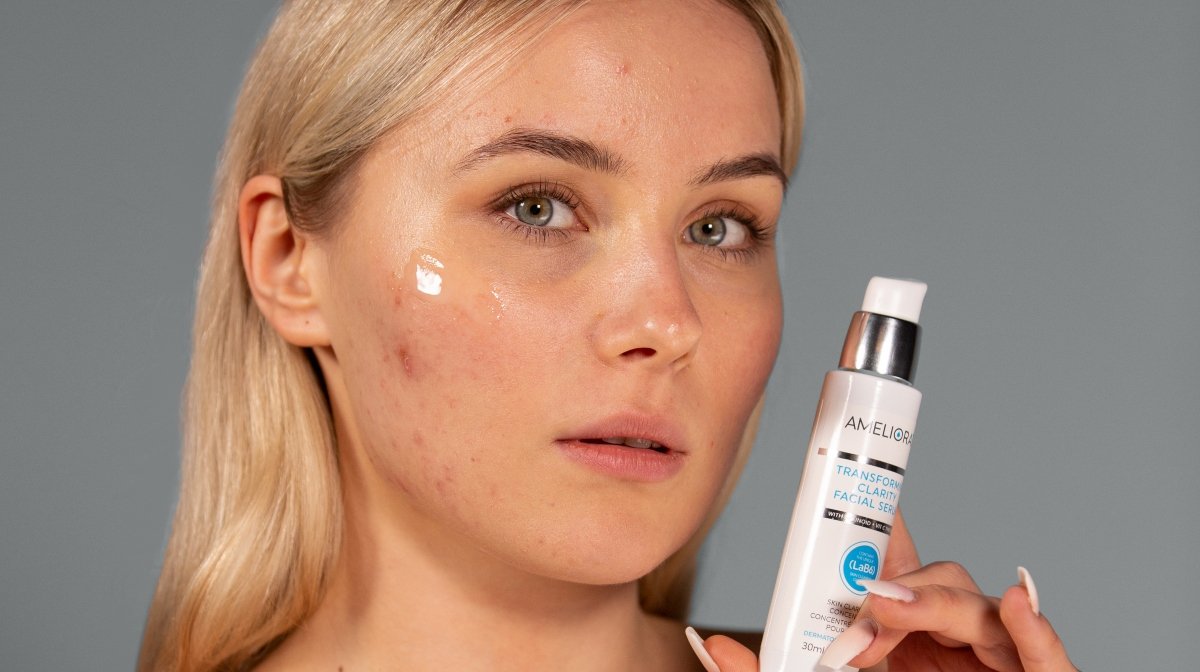 woman applying serum onto acne scars