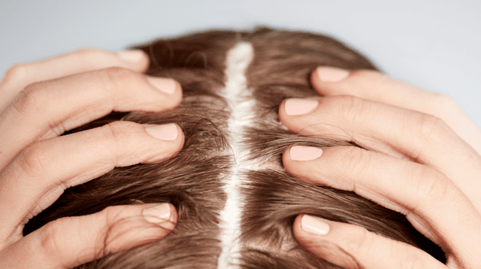 Scalp Health: Everything you need to know EXPLAINED