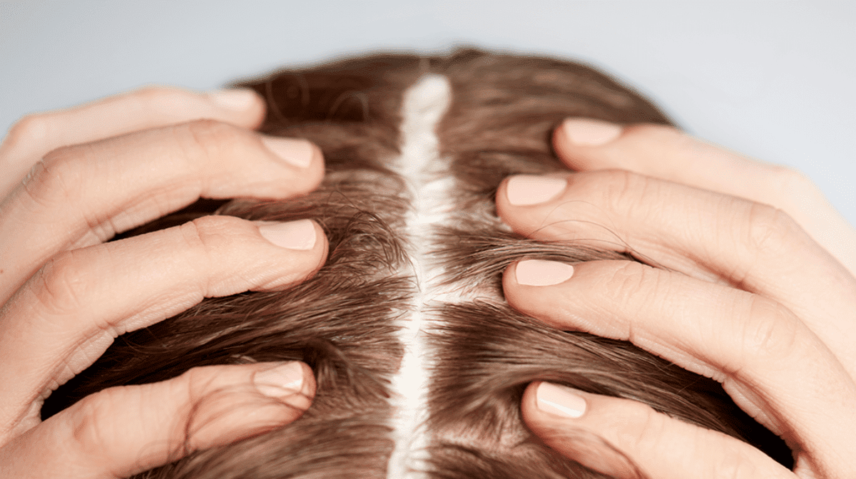 Scalp Health: Everything you need to know EXPLAINED - Ameliorate
