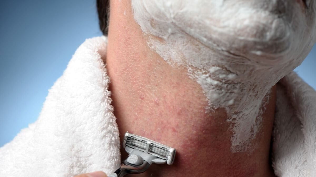 Guide to shaving with spots