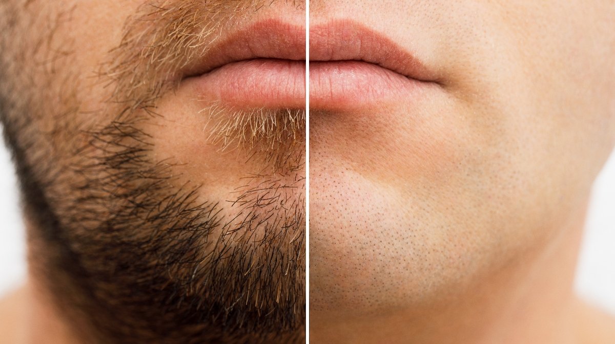 Benefits of Shaving Your Face: The Good and The Bad