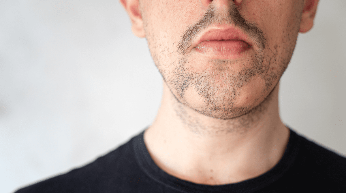 What is Alopecia Barbae | Gillette UK