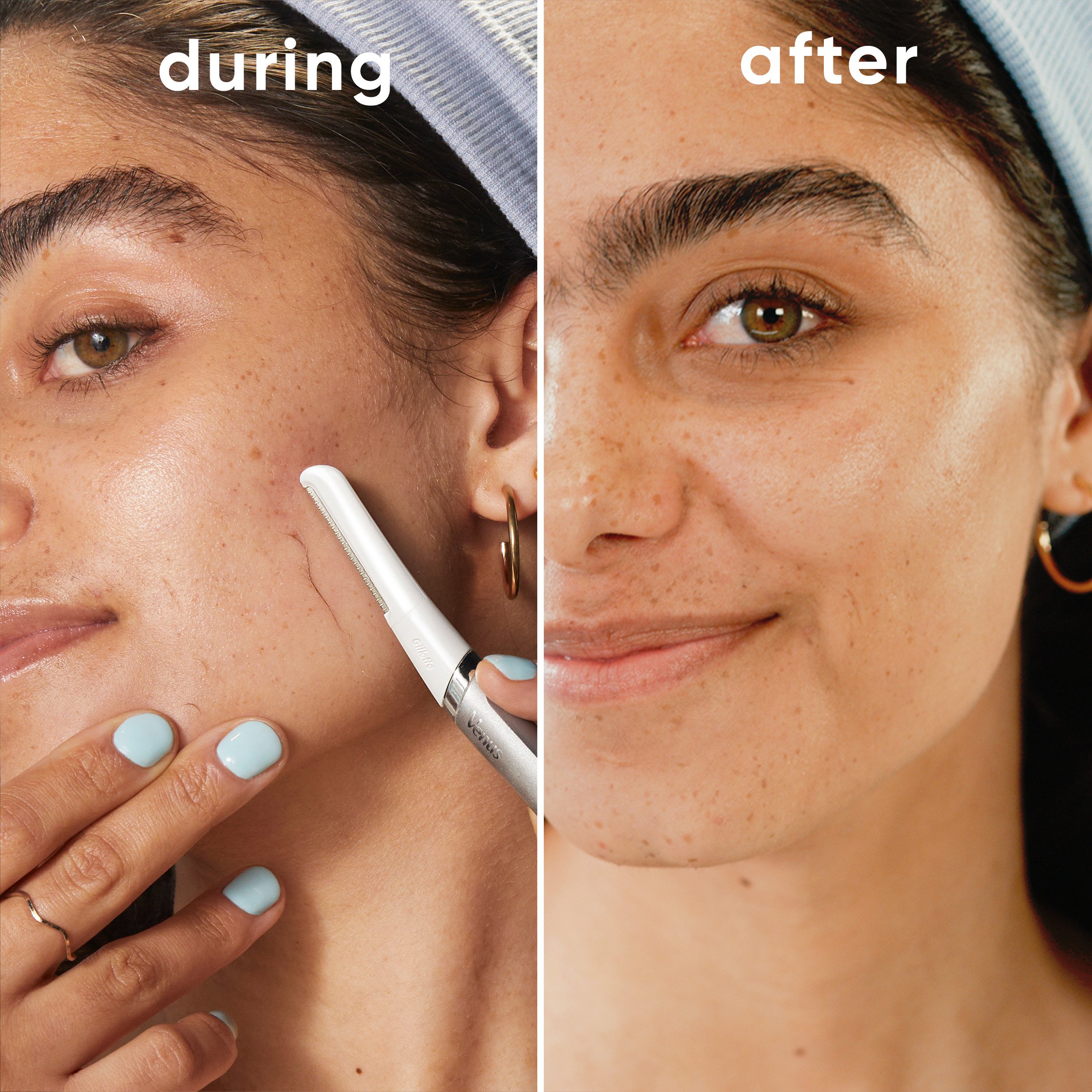 Before and after images of a woman using the Venus dermaplane tool | Venus UK