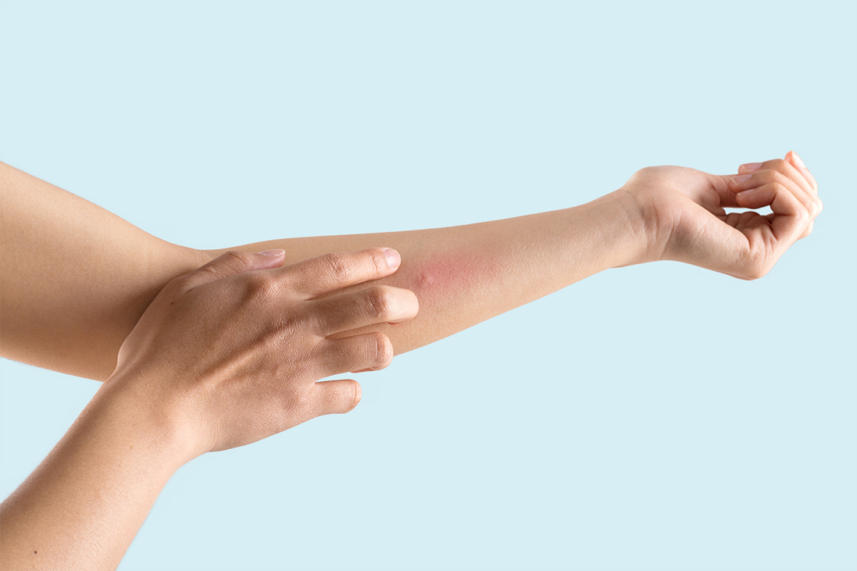 A woman touches a ingrown hair on her arm | Venus UK