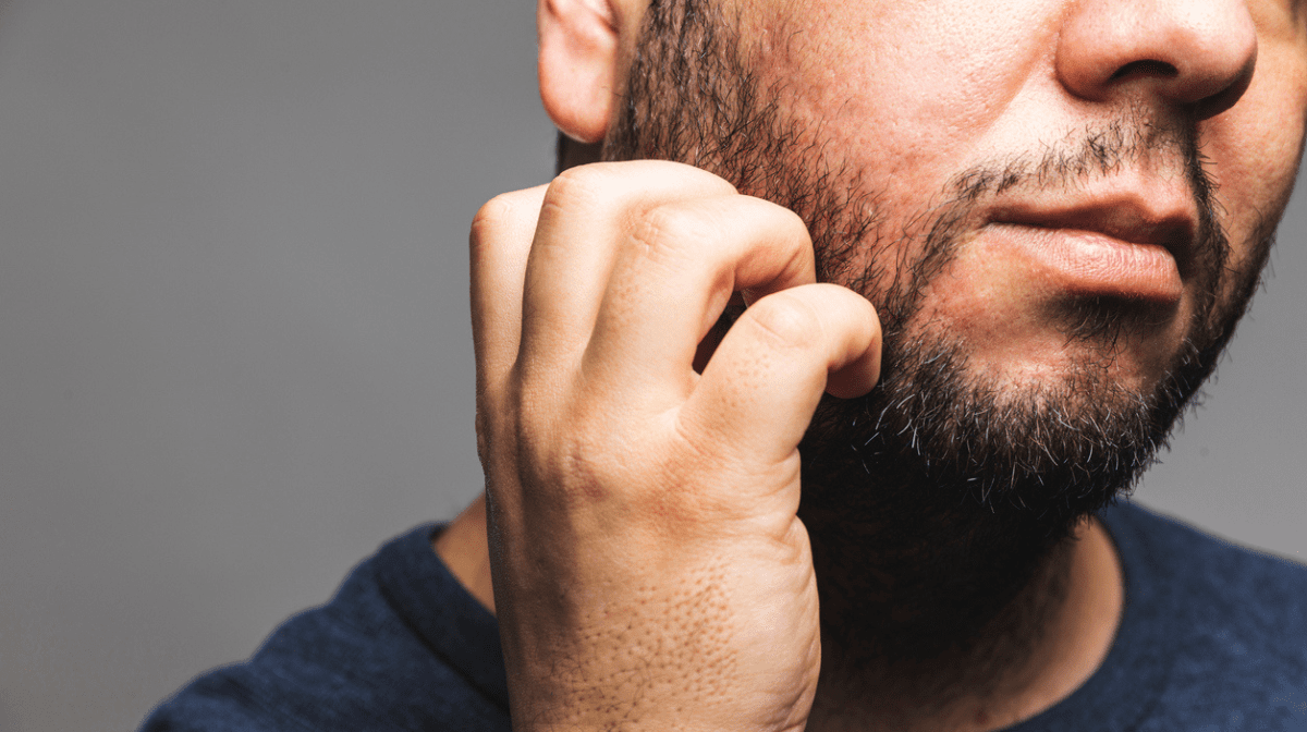 Bei trockener, gereizter Gesichtshaut kann dein Bart zu Juckreiz führen. Erfahre auf Gillette von den Jungs von Schoenhaesslich, was du dagegen tun kannst | Gillette DE