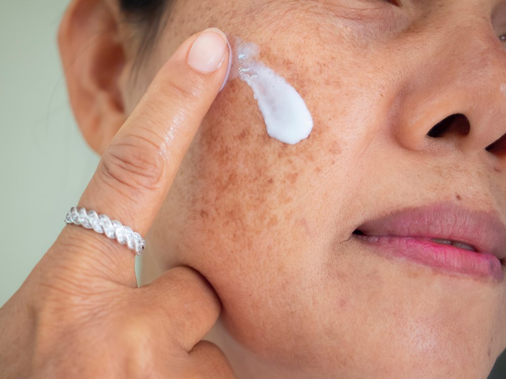 How to Reduce Hyperpigmentation | No7 Beauty