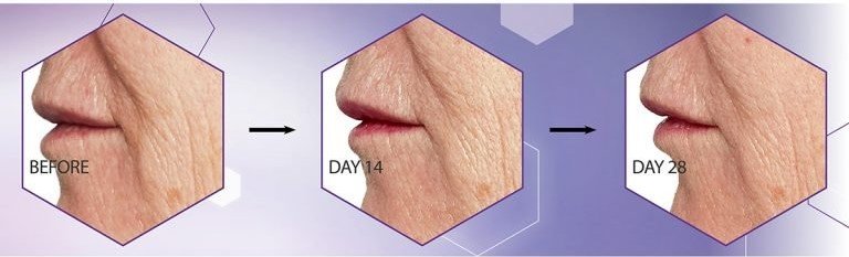 An image showing the results that No7 Pure Retinol 0.3% Complex Night Concentrate can have on the mouth area within 28 days