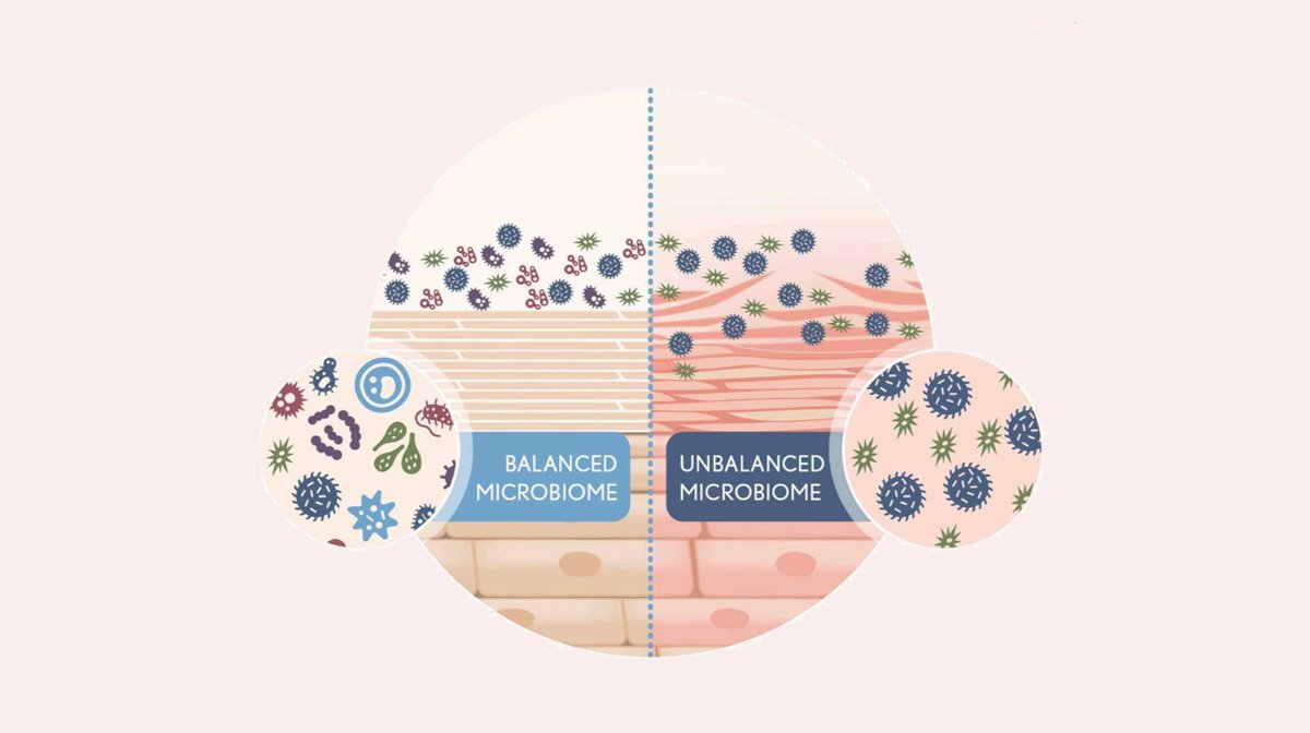 Balanced Microbiome vs Unbalanced Microbiome