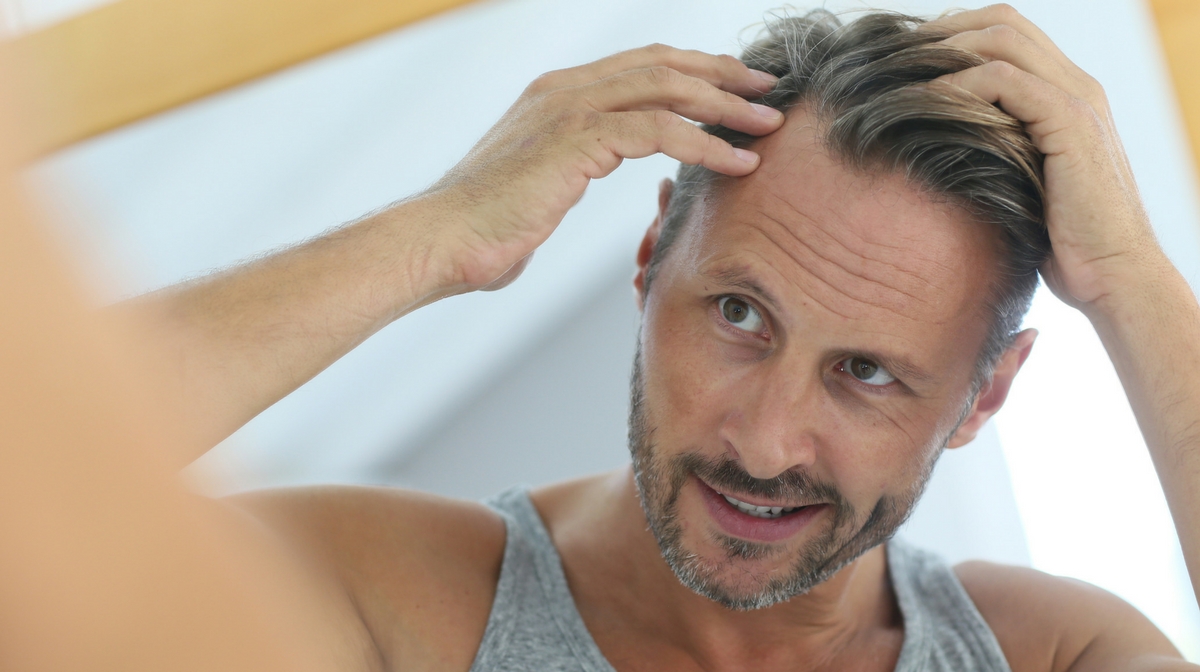 Man checking out his hairline, concerned with hair loss.