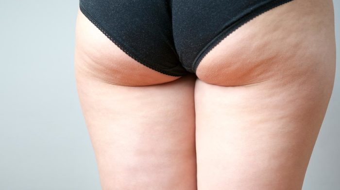 Top Cellulite Busting Tips